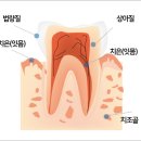 재성치과 네이버블로그