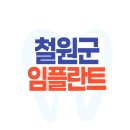 철원군 임플란트 가격 비용 싼 곳 잘하는 치과 비교추천 Top 6 | 어금니 앞니 윗니 아랫니 | 오스템 골드