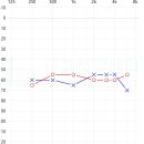 광교보청기 이미지