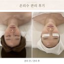 [ 결혼식 33일전] 대구피부관리 추천, 수성동 온리수 에스테틱 온리페이스 관리 후기