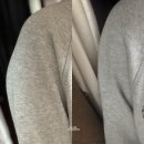 (주)아성다이소 천호점 | 팔뚝 람스 상담부터 당일 3일차 통증,가격,지점선택 후기