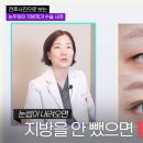 다름성형외과의원 | 서울강남 눈두덩이지방제거 잘하는곳 후기 수술법 가격