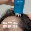 (주)대세엠.케어 | 아브카 맥주효모 헤어토닉 탈모앰플 40대 여성탈모 두피케어 4주 후기