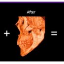 리온 메디 이미지