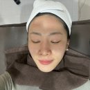 롯데백화점(관리실) | 창원피부과추천 롯데백화점 근처 스킨보톡스 후기