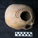 고대의료기 이미지