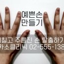피카소의원 네이버블로그