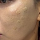 웨이브필 | 평택 힐로웨이브 기미.피부.볼륨후기!!! 일자별변화