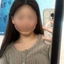 이태원의원 | 온다리프팅 경과! 3주 후기 이태원 용산피부과 추천