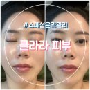 수원에스테틱 클라라피부 윤곽관리 예비신부 웨딩관리 후기