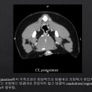 Diagnosis and Management of Urinary Ectopia 이미지