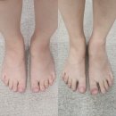 (주)예인 | 전주 임산부관리 추천! 예인에스테틱 전주점 산전관리 후기