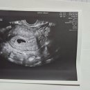 용인에스의원 이미지