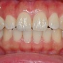 이프라임치과기공소 이미지