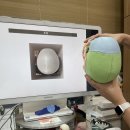 담주한의원 | 연예인 교정: 분당얼굴비대칭교정 <안면비대칭 교정 1회차> 턱관절 교정하는 한의원