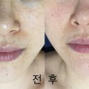 나겸 피부관리