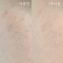 스킨부스터 기미앰플 : 클래시엘리먼츠 바르다 EGF 나이아신아마이드 앰플 리얼 후기