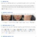 거상광고