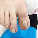 푸스케어 남포점 글림네일 이미지