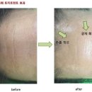 피부에설레다 이미지