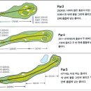 골 이미지