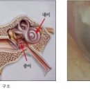 포낙보청기수원센터 이미지