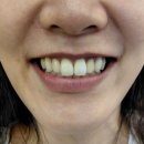 누가치과기공소 이미지