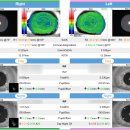 e편한 안경 이미지