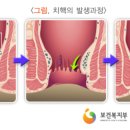 항문건강 십계명 이미지