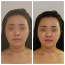 보라매온누리약국 | 보라매 피부관리 &#39;행복에스테틱&#39; 황금비율 윤곽관리 후기