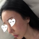 홍외과의원 | 줄기세포피부주사 스킨부스터, 고압산소챔버로 안티에이징 프레쉬홍닥터 후기(가격, 효과)