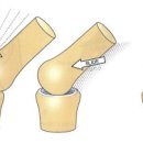 멀리건 | [MES 세미나] 멀리건 테크닉(MWM) 정복기! 관절 가동범위가 고민이라면? (feat. 비산동 쿼카짐)