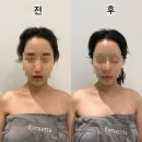 광산구-151 | 광주 에스테틱 <에스테티아 첨단1호점> 광주예신관리 | 윤곽관리