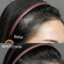 헤어브로시(Hair bro | 강남 언주 we Bro SMP – 핫한 헤어라인 시술 맛집!