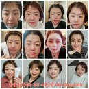 찬스인셀덤 이미지