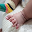 유소아과의원 | 병원기록_ 발가락이 빨갛게 부어, 가양동 유소아과 진료 후기