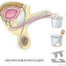 [풀마루/임풀맘] 불임검사, 정액검사에 대해 알아 보아요 (흑마늘 진액, 흑마늘 효과) 이미지