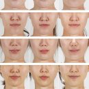 씨에스메드 이미지