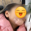 한강수 | 한강수 병원 완치 후기 (수면 마취, 봉합, 흉터 레이저)