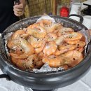 갑상선 항진증 앓았던(앓는) 후기