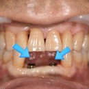 바름치과기공소 이미지
