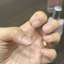 요뜨네일