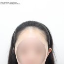 모델헤어라인 이미지