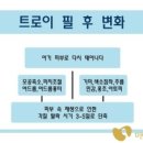 트로이홈케어
