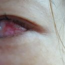 칠곡대구안과의원 이미지