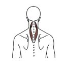 목널판근, 목덜미 통증을 가져오는 근육 이미지