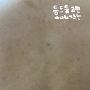 더마솔루션 | 등드름 바디워시 추천 더마솔루션 세라테놀 솔직후기