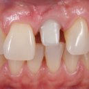 맑음치과기공소 이미지