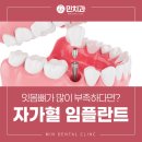 대구민치과의원 네이버블로그