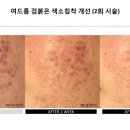 피지아이주